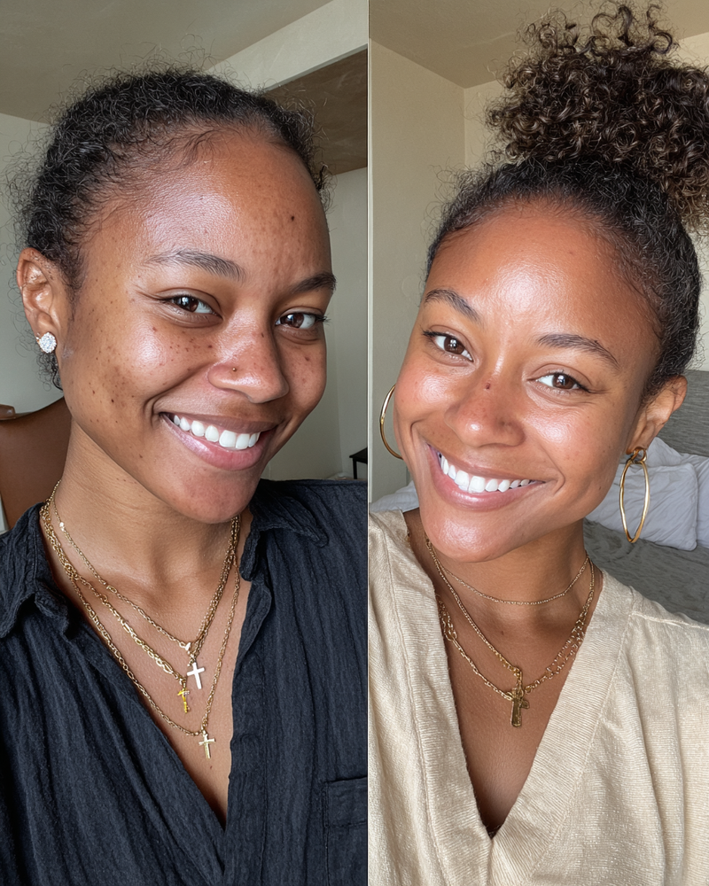Before and after — Oily & combination
