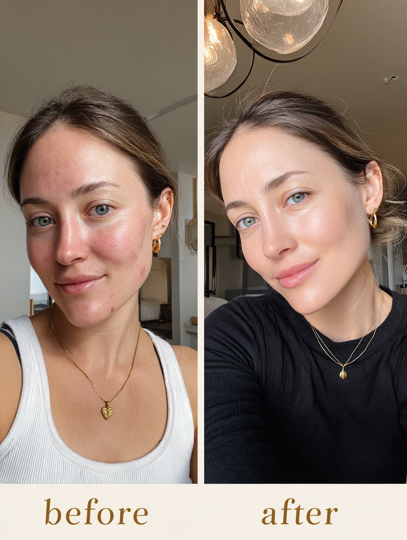 Before and after — Dry & flaky